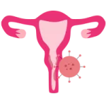 detección cáncer cervicouterino