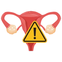 malformaciones uterinas Especialista en Histeroscopia en Pachuca