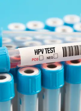 prueba de pcr para vph VPH en Pachuca