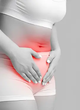 Especialista en Endometriosis en Pachuca